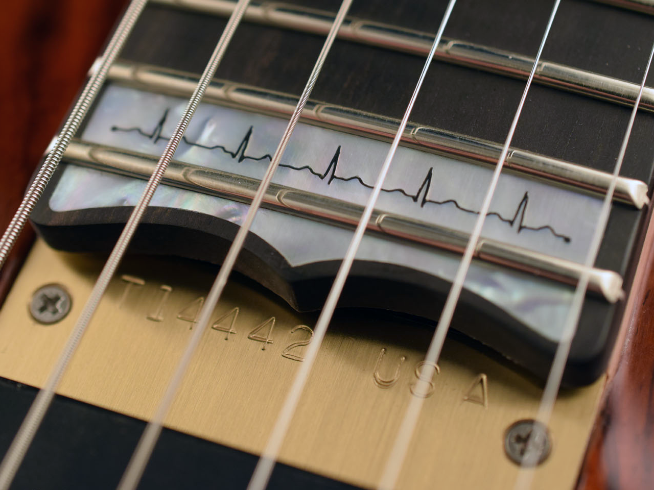 Normal sinus rhythm nameplate inlay