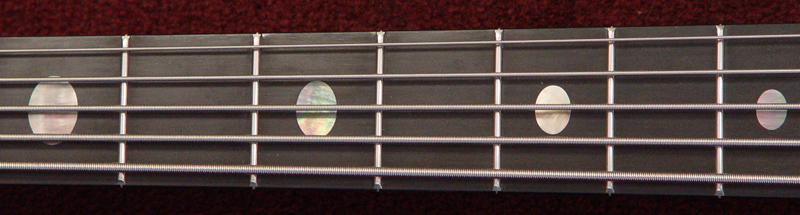 inlays